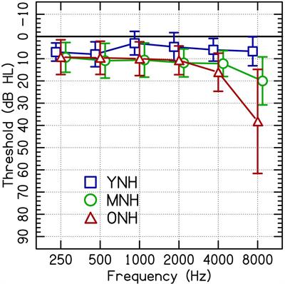 The recognition of time-compressed speech as a function of age in listeners with cochlear implants or normal hearing